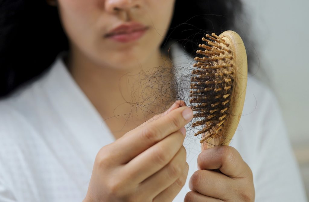 Telogen Effluvium Symptoms 1 telogen effluvium symptoms